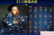 什么原因会怀上唐氏儿(什么原因会怀上唐氏儿女)