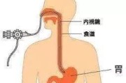 做胃镜疼么
:胃镜痛苦吗？做胃镜前要做些什么准备？