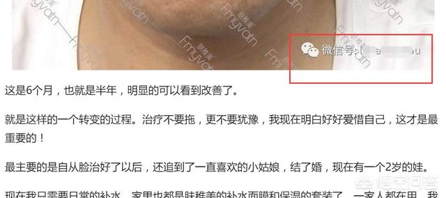 免费推广方案
:除了微信推广，还有更好的推广方式吗？