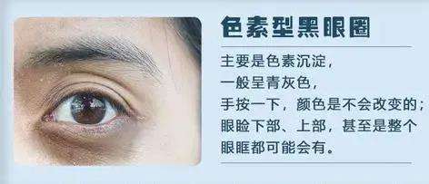 黑眼圈的图片(熊猫没有了黑眼圈的图片)