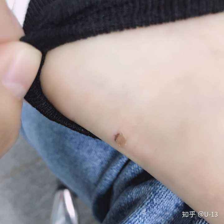 鞋子磨脚后跟怎么处理(帆布鞋鞋子磨脚后跟怎么处理)