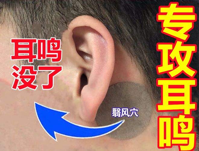 治疗耳鸣小方法(治疗耳鸣的小技巧)