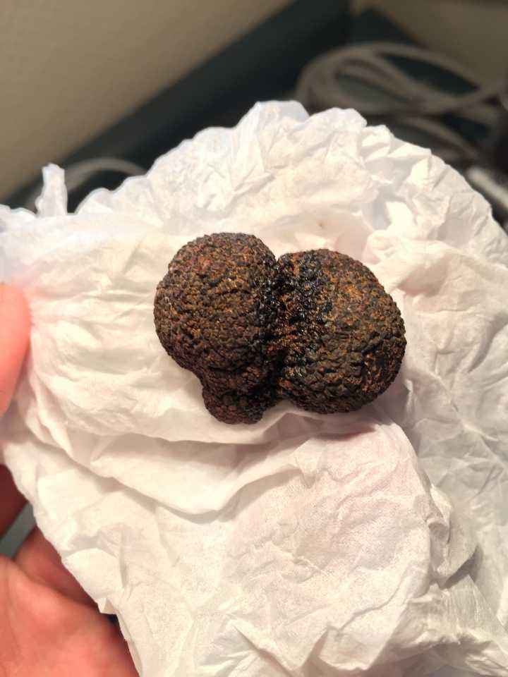 松露是什么东西(阿尔白松露是什么东西)
